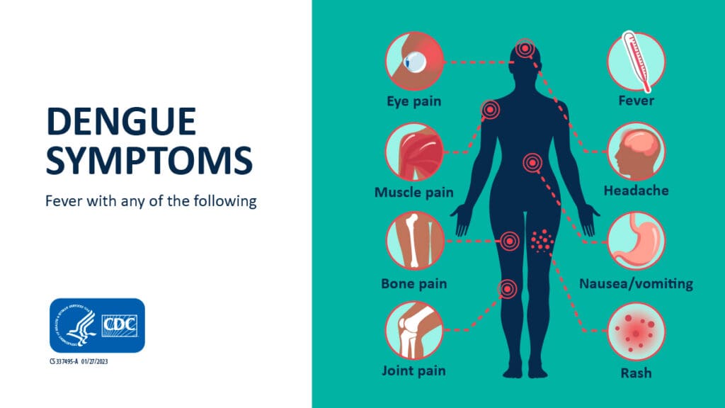 cdc graphic of mosquito borne disease dengue symptoms 