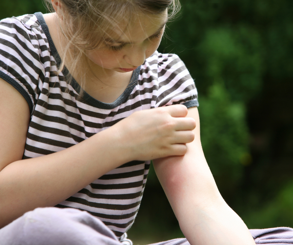 itchy mosquito bite